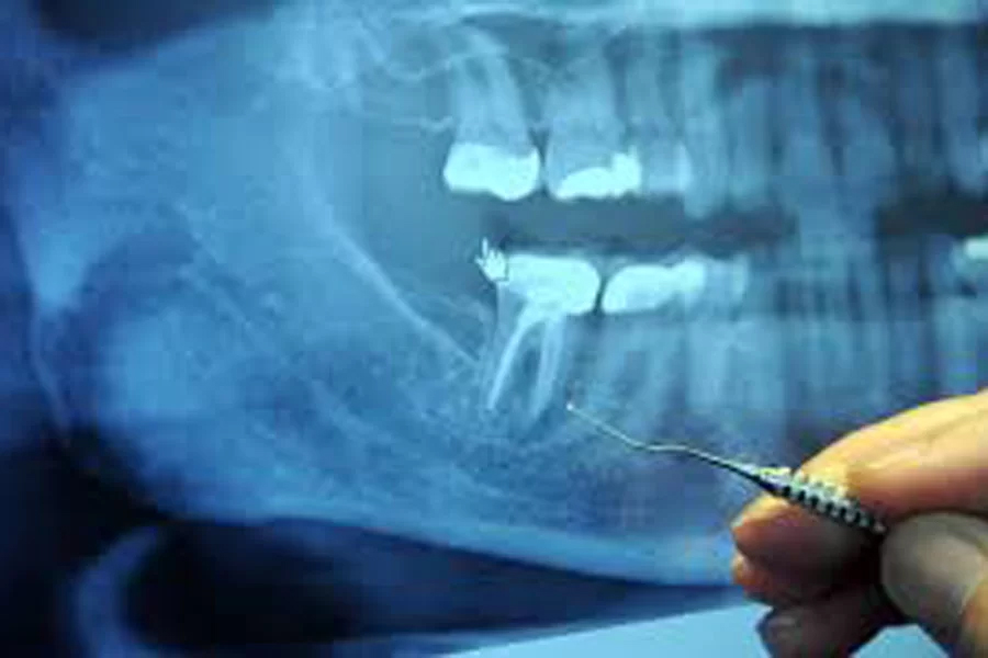 三鷹（三鷹市下連雀）の歯医者、川島歯科医院のマタニティ歯科