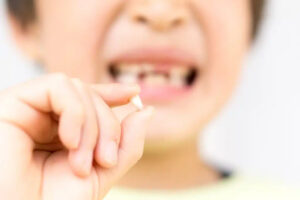 三鷹の歯医者、川島歯科医院で、ガチャ歯（叢生）とは？原因やリスク、治療法を解説