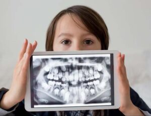 三鷹の歯医者、川島歯科医院で、ガチャ歯（叢生）とは？原因やリスク、治療法を解説